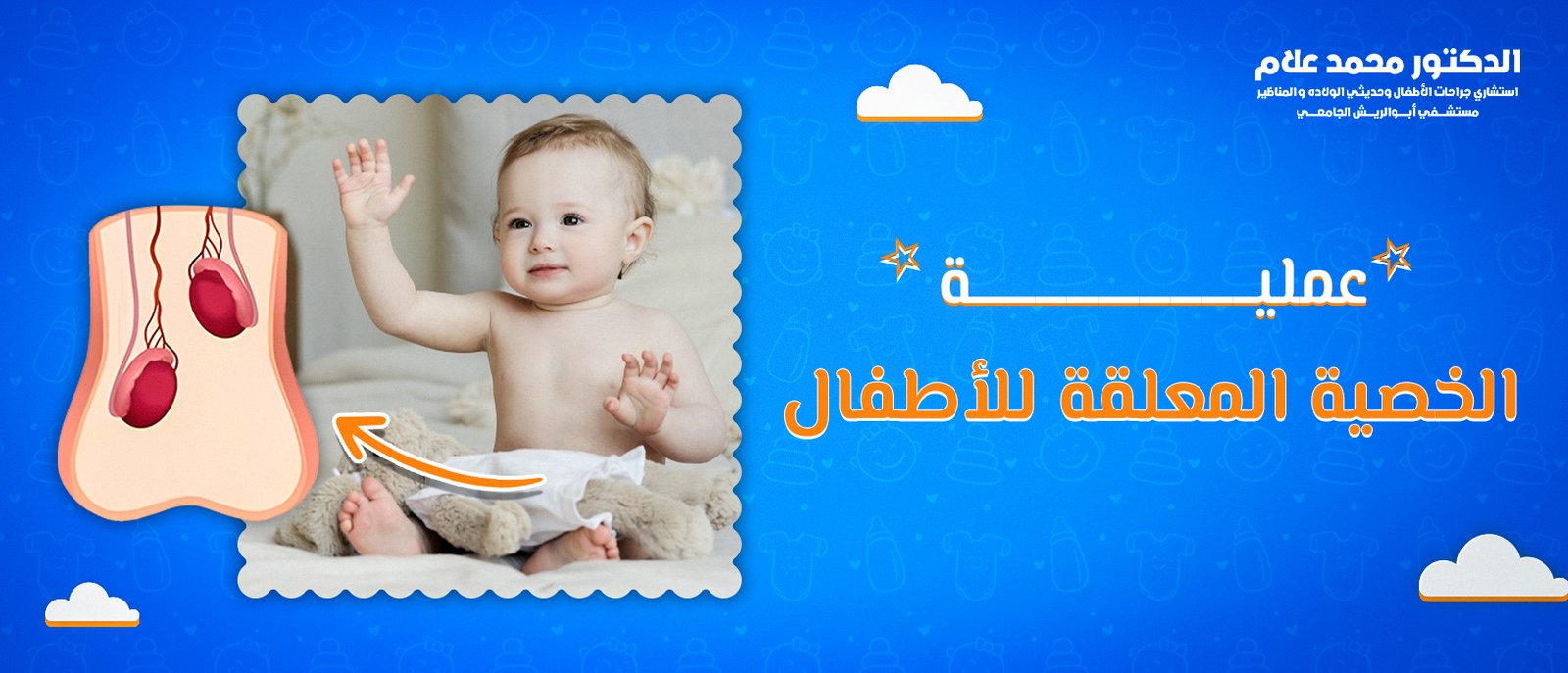 أفضل طرق ختان الأطفال الذكور
