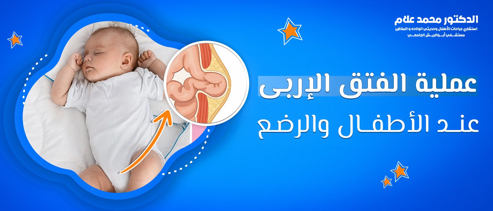 أفضل طرق ختان الأطفال الذكور