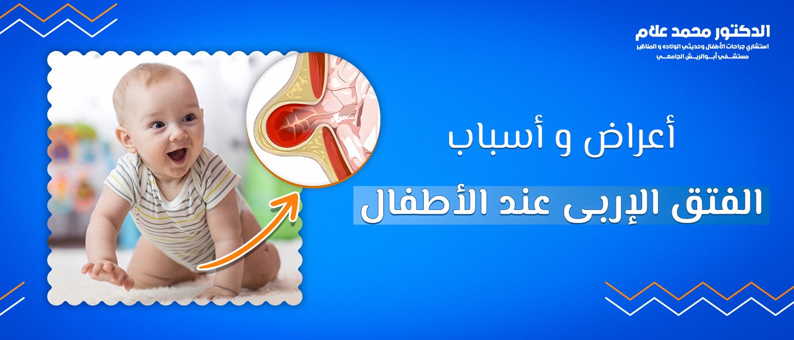 العناية بالطفل بعد الختان