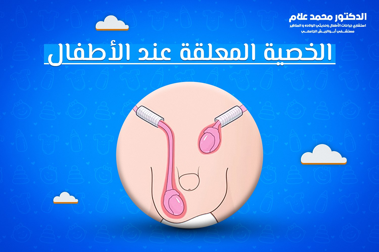 الخصيه المعلقه عند الأطفال