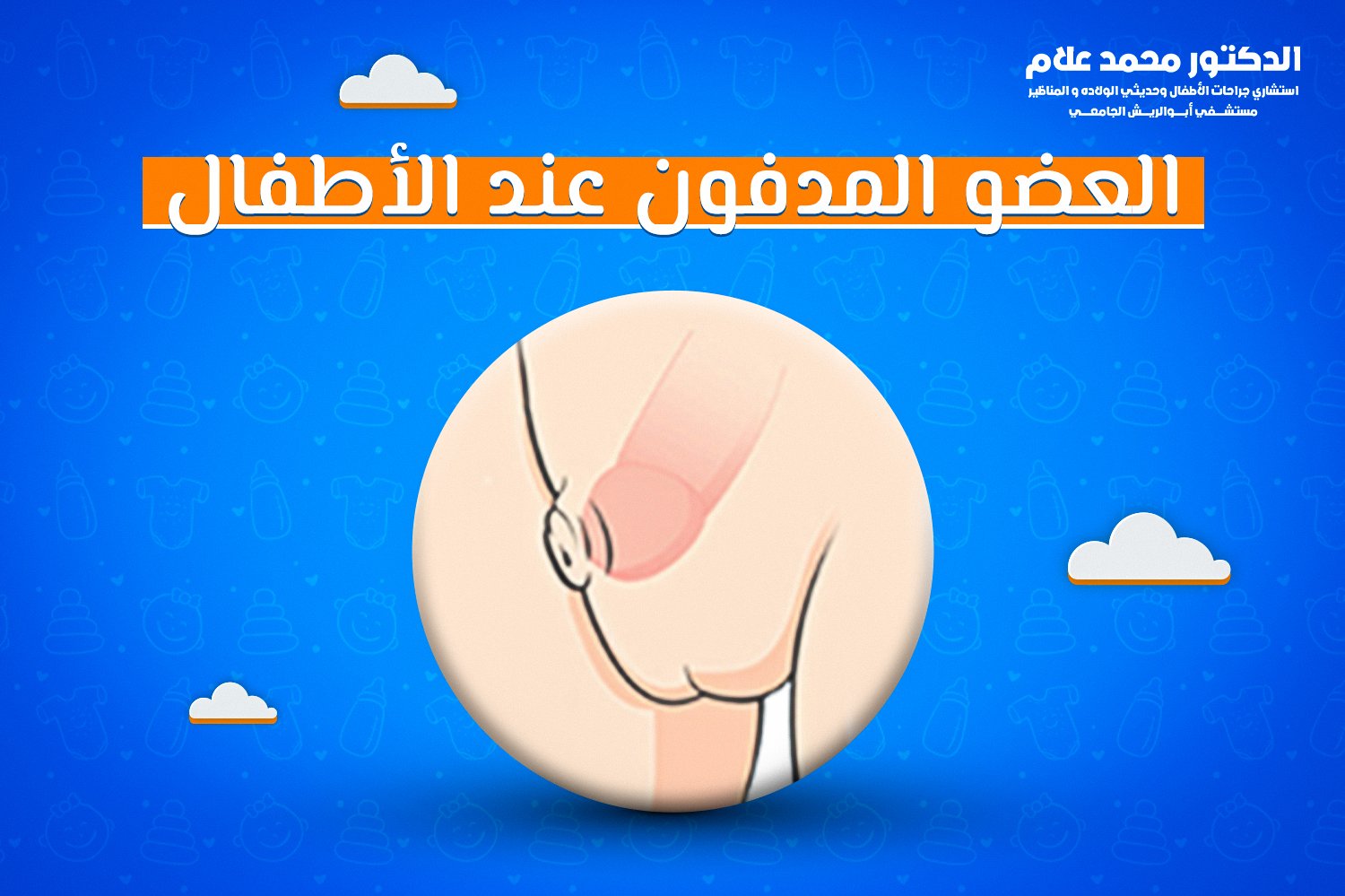 العضو المدفون عند الأطفال