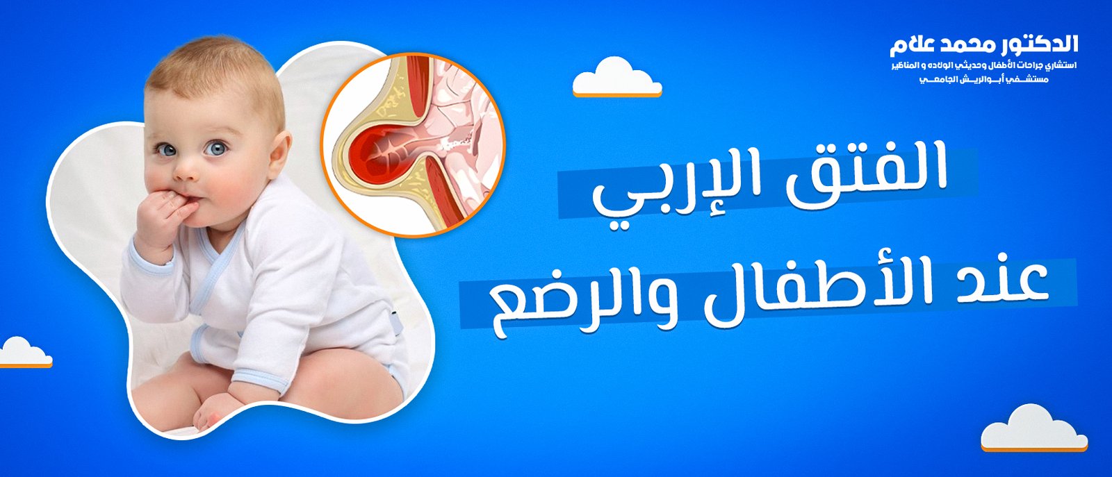 العناية بالطفل بعد الختان