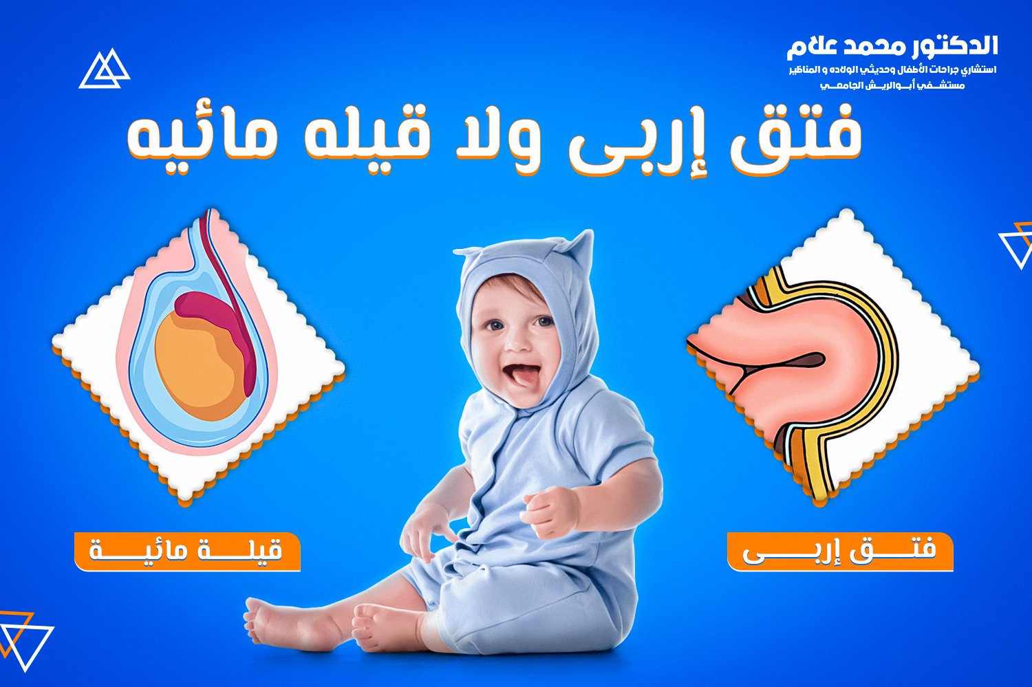  ختان الأطفال بجهاز الجومكو