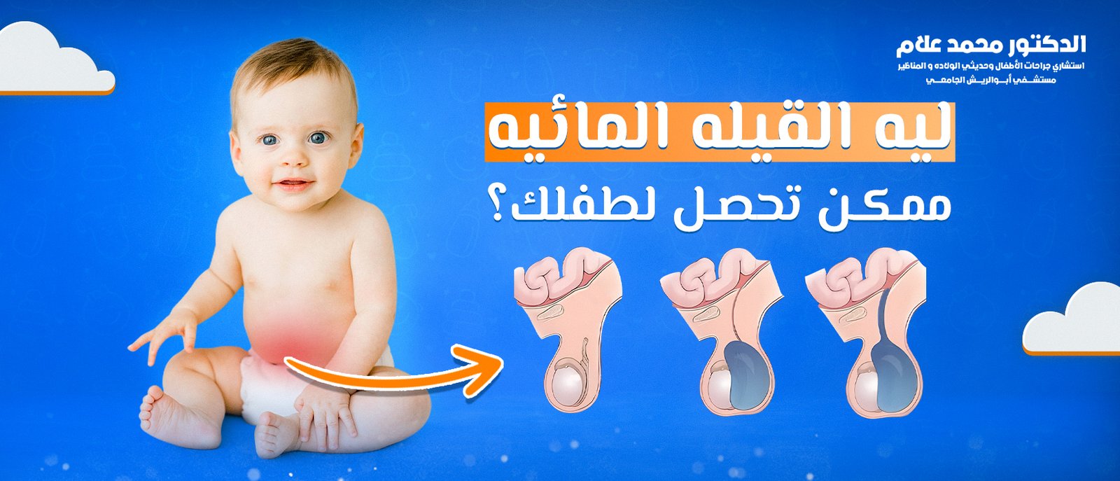 العناية بالطفل بعد الختان