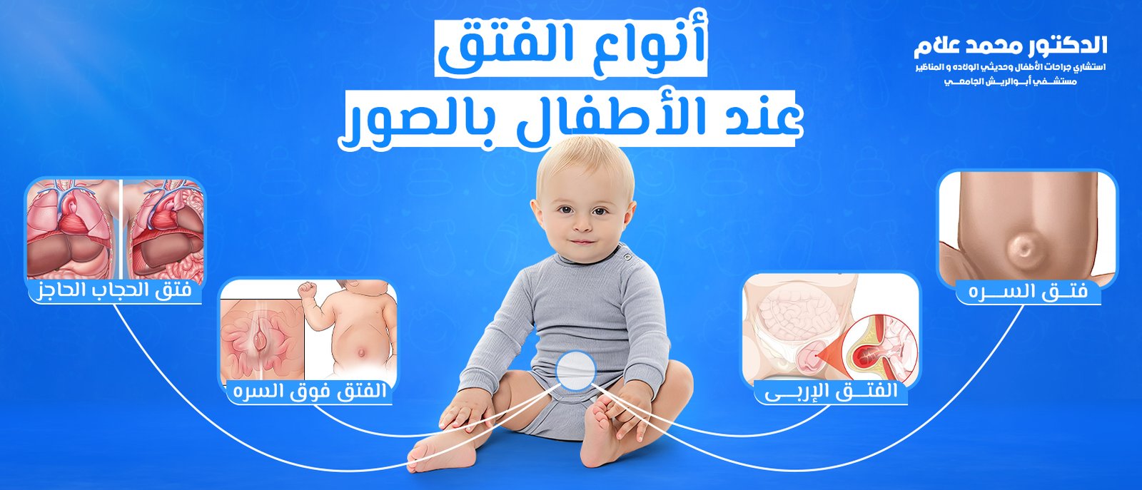 العناية بالطفل بعد الختان