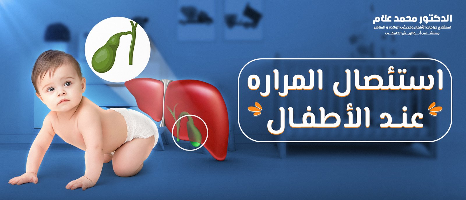 استئصال المراره عند الأطفال