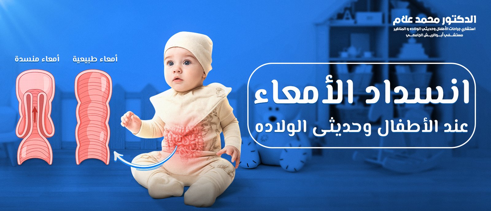 ​انسداد الأمعاء عند الأطفال وحديثي الولادة