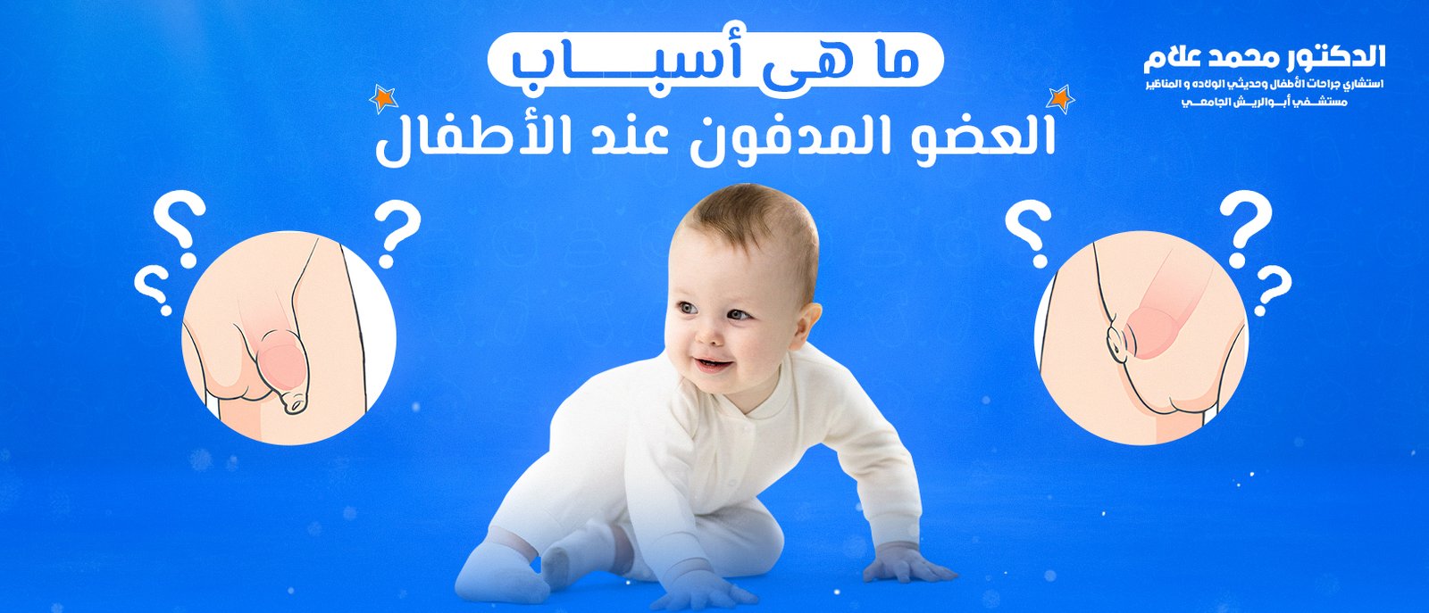 العناية بالطفل بعد الختان