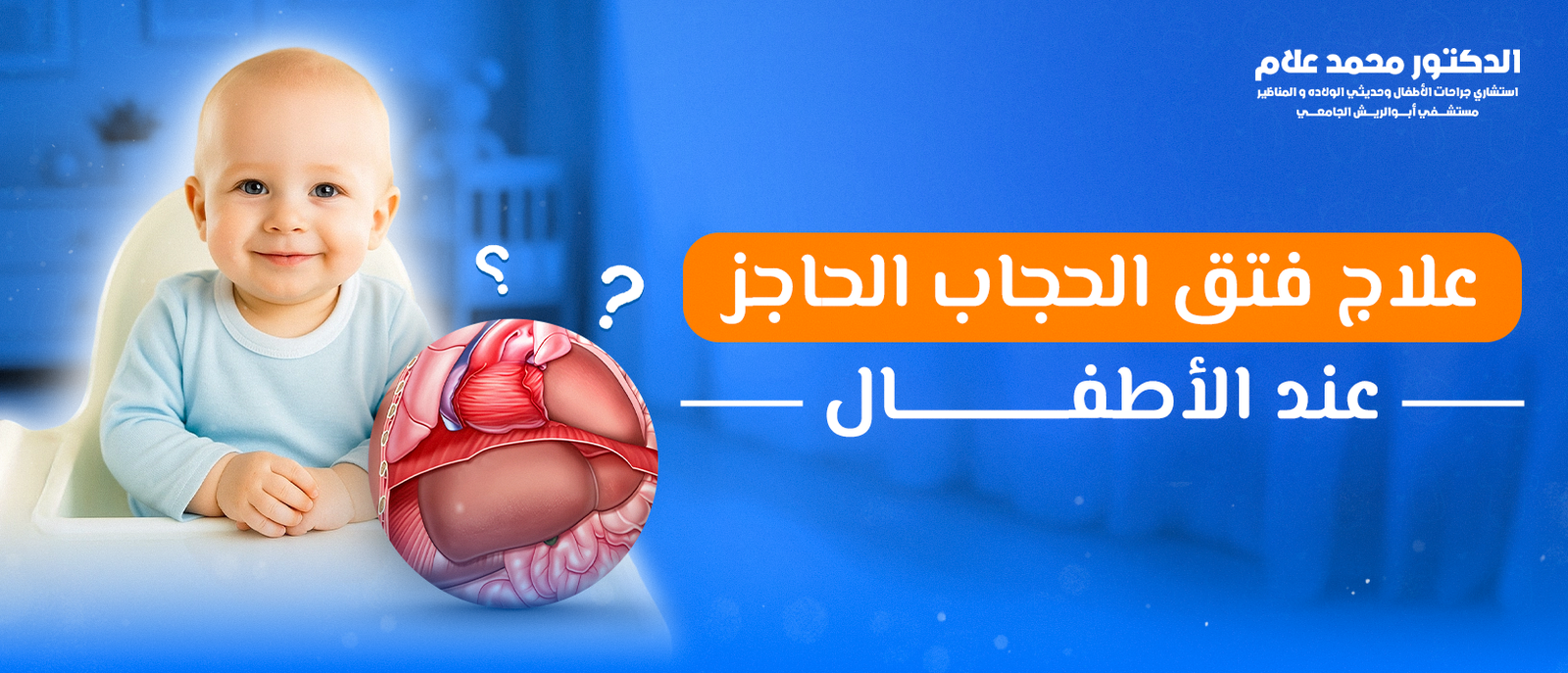 علاج فتق الحجاب الحاجز عند الأطفال