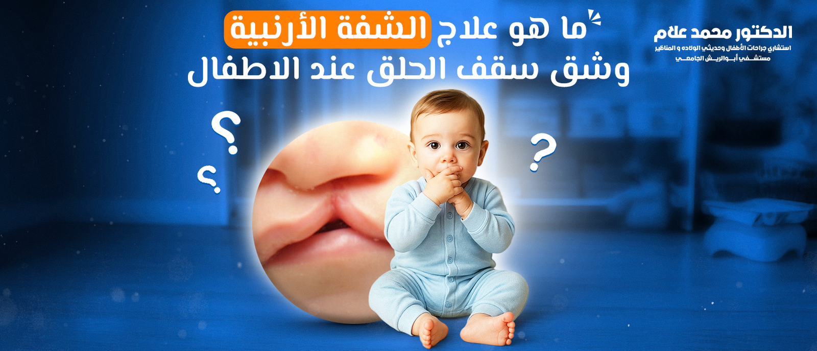 ما هو علاج الشفة الأرنبية وشق سقف الحلق عند الاطفال