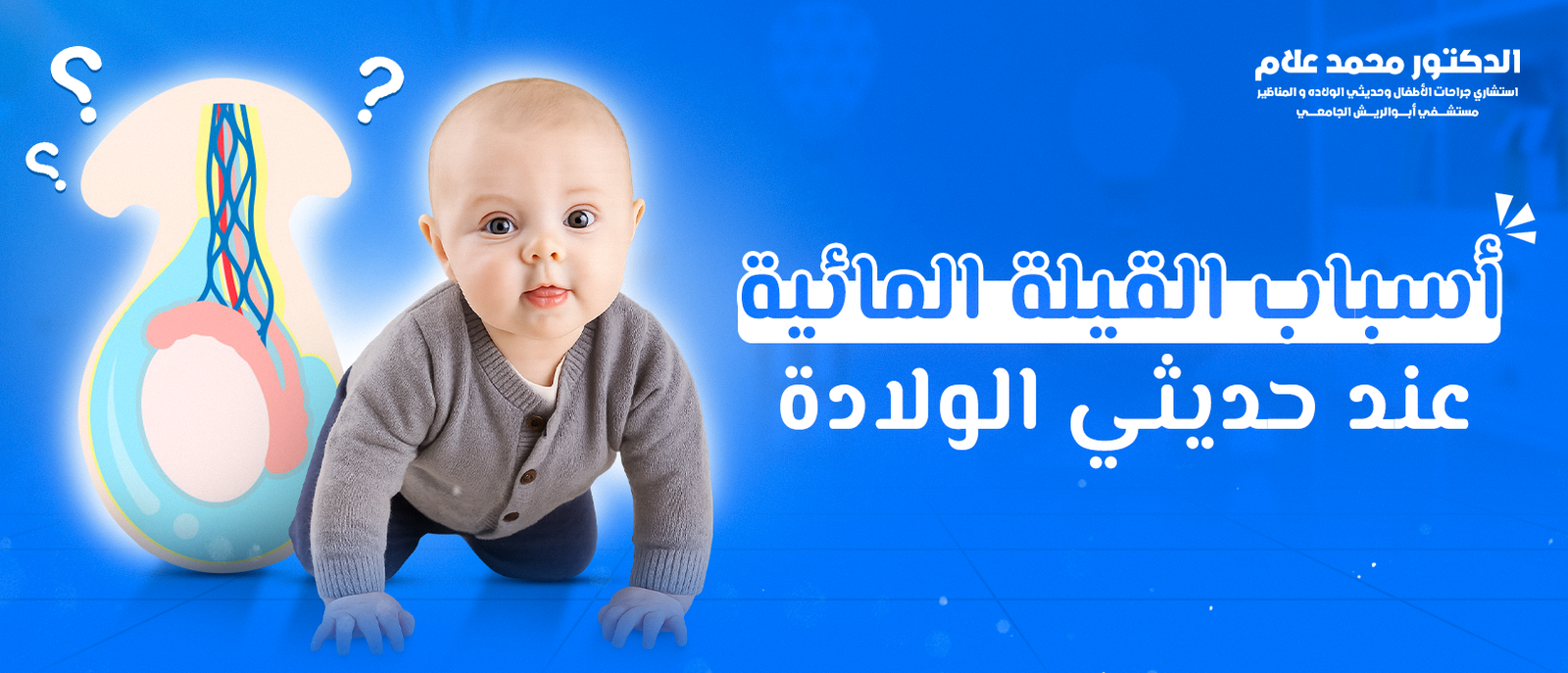 أسباب القيلة المائية عند حديثي الولادة