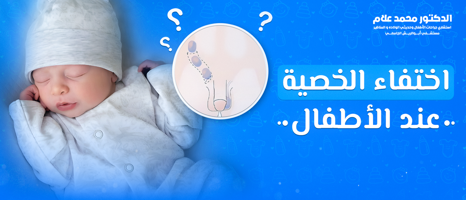 ​اختفاء الخصية عند الأطفال