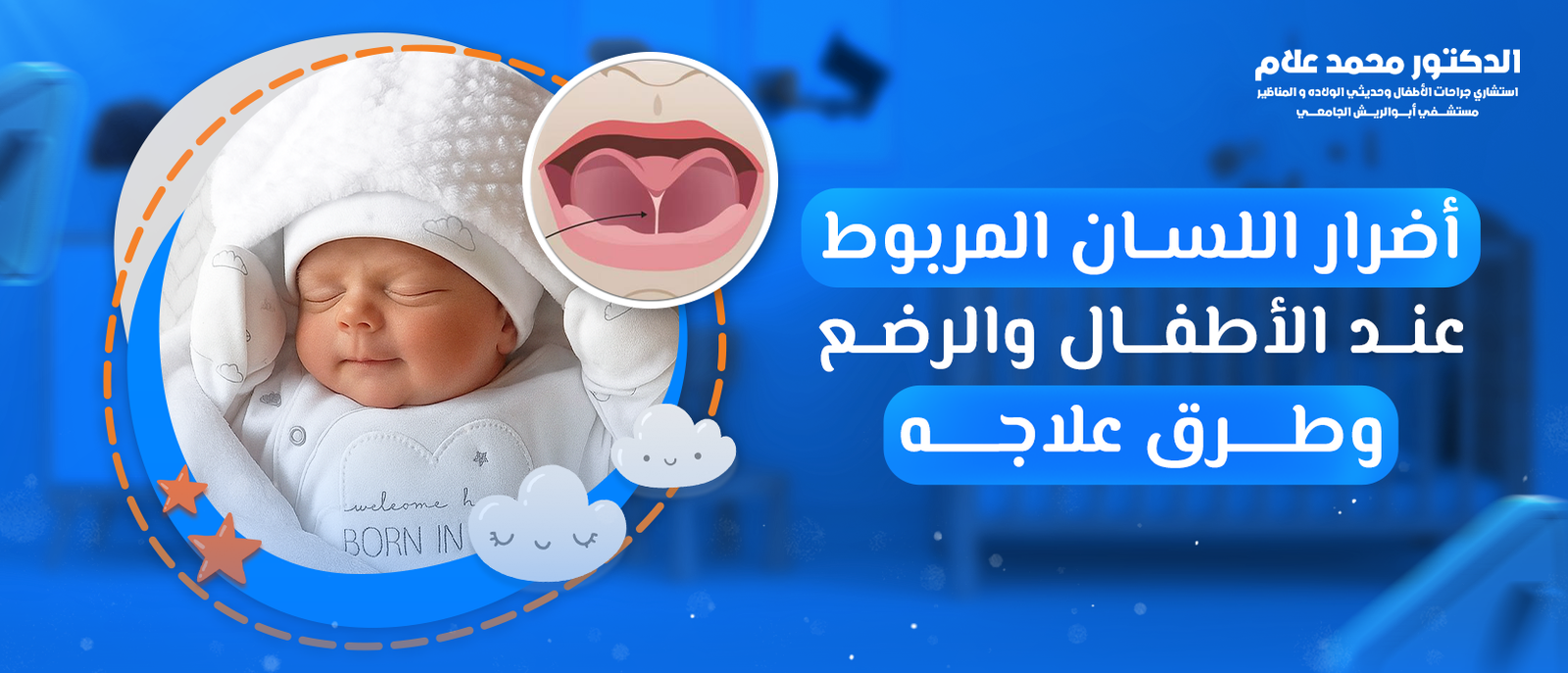 أضرار اللسان المربوط عند الأطفال والرضع وطرق علاجه